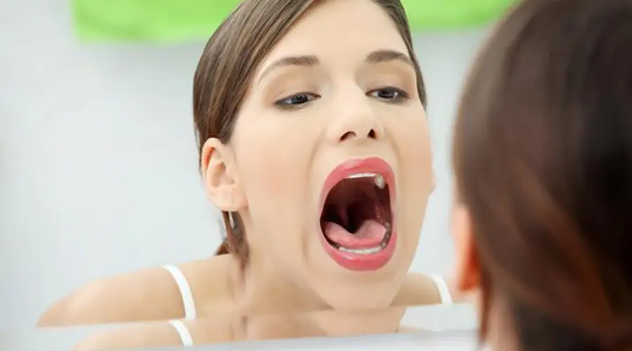 Καυσαλγία στόματος - Αρθρογραφία - Dental Kittas Ιωάννινα