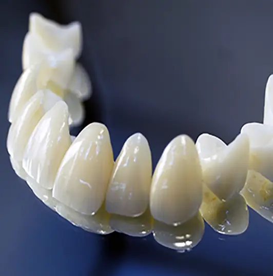 Ψηφιακές προσθετικές αποκαταστάσεις - Αισθητική οδοντιατρική - Dental Kittas Ιωάννινα